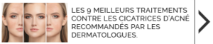 Les 9 meilleurs traitements contre les cicatrices d’acné recommandés par les dermatologues.
