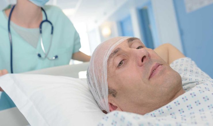 Greffe de cheveux mythe ou réalité