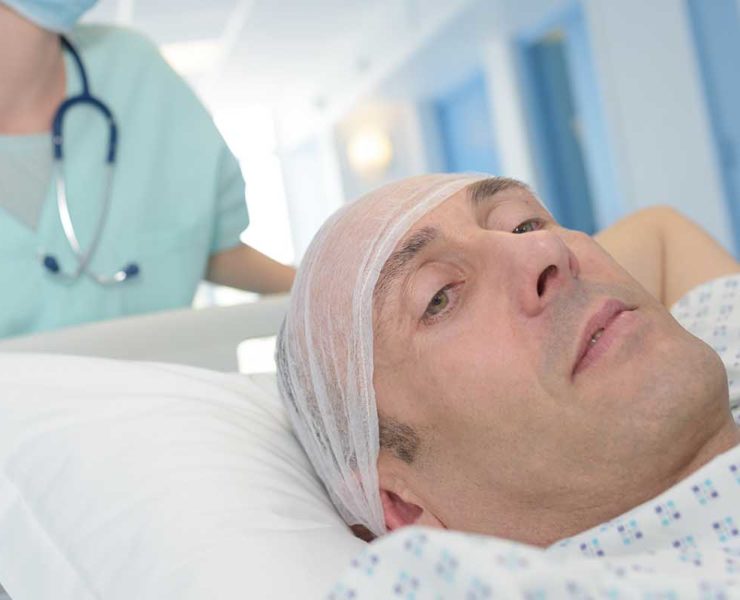 Greffe de cheveux mythe ou réalité